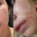 Nóng: Hằng Du Mục công khai toàn bộ hình ảnh bị chồng bạo hành tàn nhẫn, tuyên bố thời điểm ly hôn